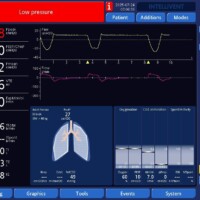 Switching to volume control is not the answer to control tidal volumes. This would be extremely uncomfortable and harmful to the patient.