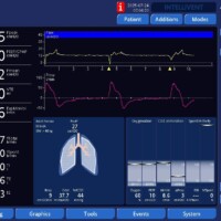 Work Shifting on APV