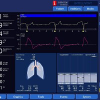 Early Trigger and Work Shifting on APV