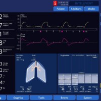 Early trigger in APV fixed with transitioning the mode to pressure support