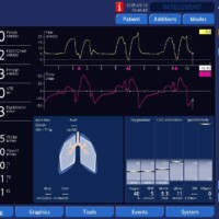 Early Triggering on APV