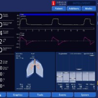 False triggering resolved after draining the circuit