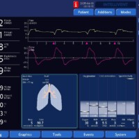 Early trigger resolved with dropping the set respiratory rate