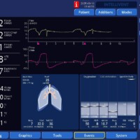 Early trigger - note how small is the last recorded tidal volume (left-side, under VTE).