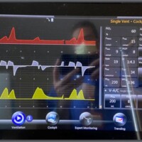 Early cycle in Volume Control