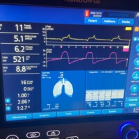 Case 9: Late Cycling in APVcmv Late Cycling in APVcmv