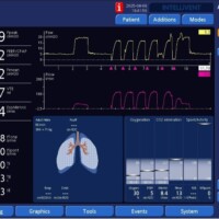 False trigger due to patient-ventilator disconnection
