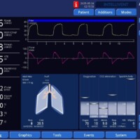 Impact of Sedation on Work Shifting
