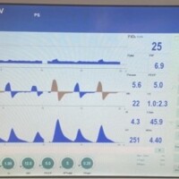 Work Shifting on Autoflow: Comparison Against Pressure Support