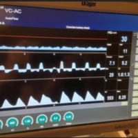 Work Shifting on Autoflow