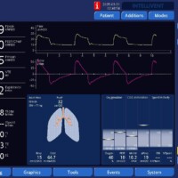 Flow Dyssynchrony/Work Shifting in VC Descending Ramp Flow with Troubleshooting