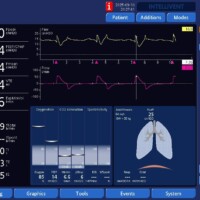 Flow Dyssynchrony/Work Shifting in VC Descending Ramp Flow with Troubleshooting