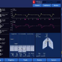 Flow Dyssynchrony/Work Shifting in VC Square Flow with Troubleshooting
