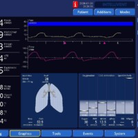 Troubleshooting increased work of breathing seen with modes using an adaptive targeting scheme