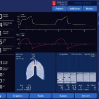 Troubleshooting increased work of breathing seen with modes using an adaptive targeting scheme