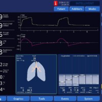 Troubleshooting increased work of breathing seen with modes using an adaptive targeting scheme