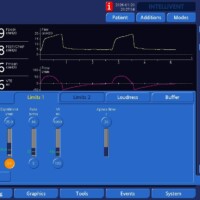 Troubleshooting increased work of breathing seen with modes using an adaptive targeting scheme