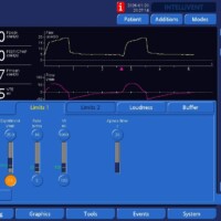 Troubleshooting increased work of breathing seen with modes using an adaptive targeting scheme