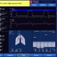 Important Alarm in APV: High Pressure Limit