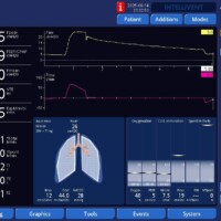 Impact of Leaks on Peak Pressure on APV