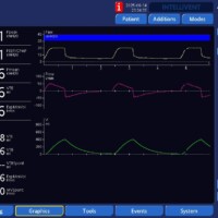 Impact of Leaks on Peak Pressure on APV