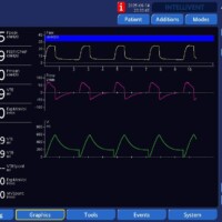Impact of Leaks on Peak Pressure on APV