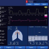 Illustration of Adaptive Targeting Scheme on APV