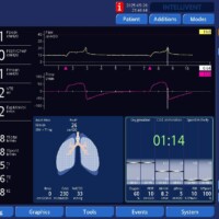 Late Cycle in PSV