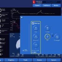 Late Cycle in PSV - Adjusting ETS