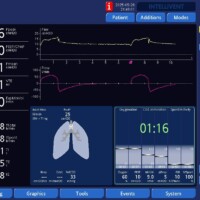 Late Cycle Resolved in PSV After Adjusting ETS
