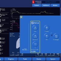 Late Cycle in PSV - Adjusting ETS
