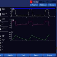 Impact of iTime on Peak Pressures on APV