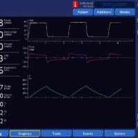 Impact of iTime on Peak Pressures on APV