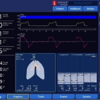 Inspiratory Effort In Pressure-Limited Modes