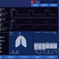 Effects of Effort on Waveforms