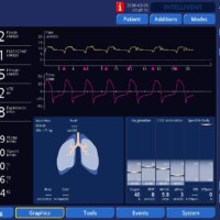 Effects of Kink in Endotracheal Tube